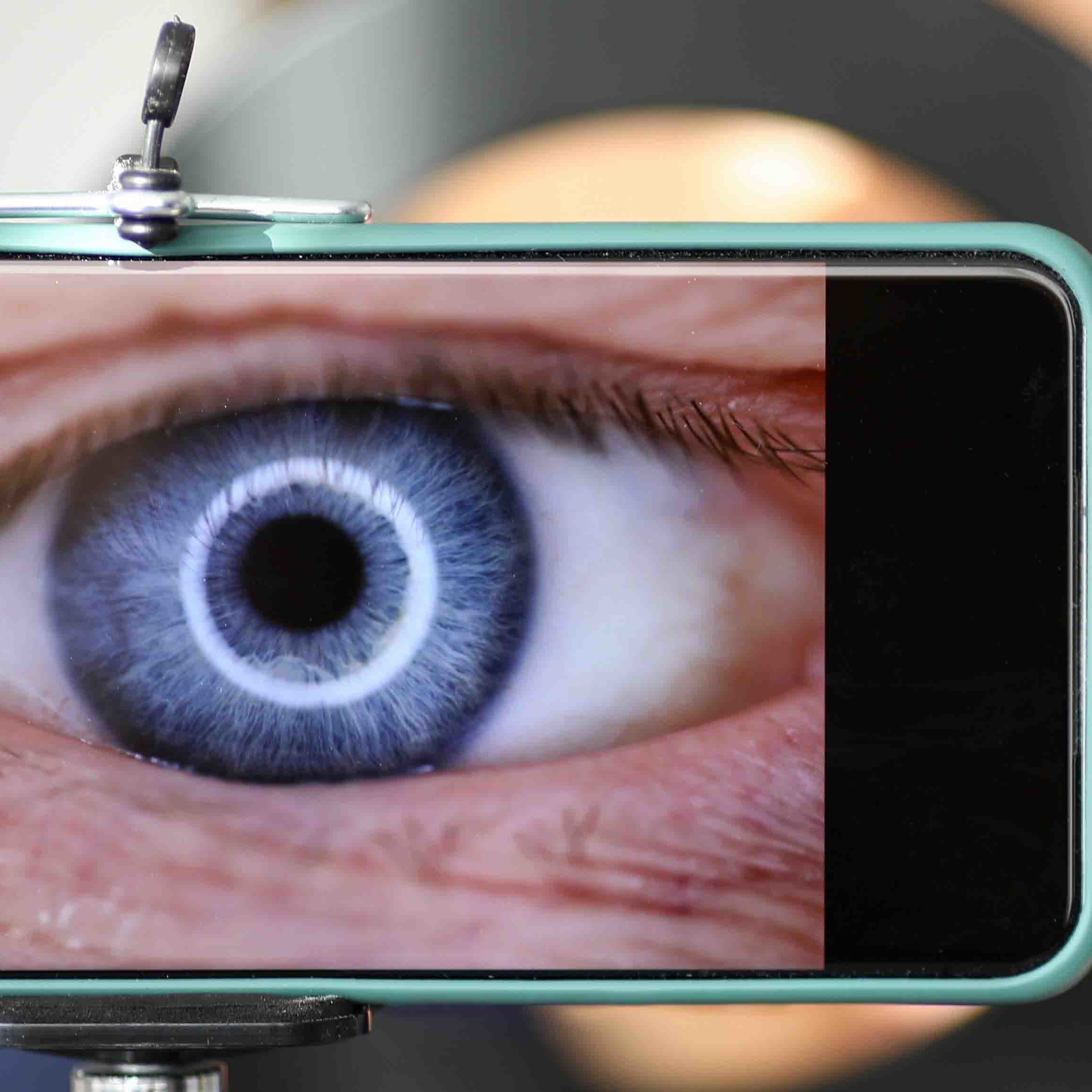 D-Eye
